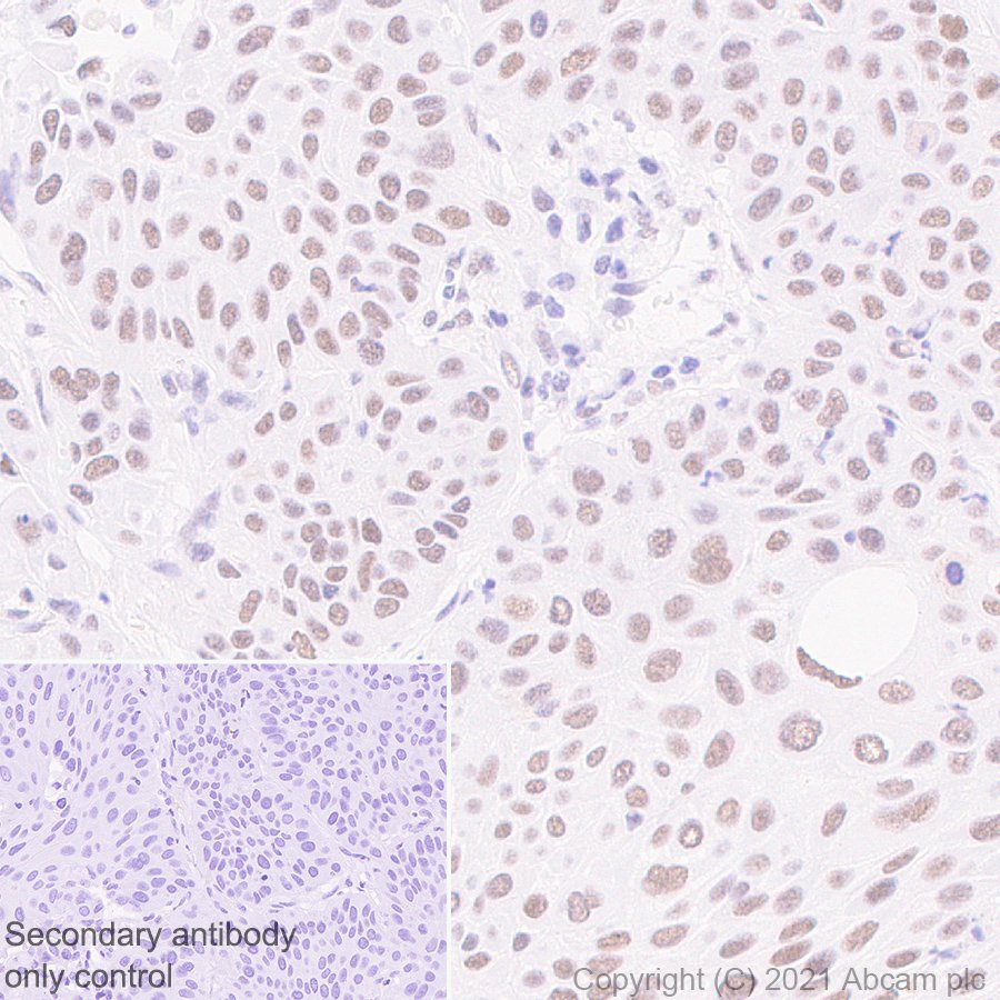 Immunohistochemistry (Formalin/PFA-fixed paraffin-embedded sections) - Anti-BAP1 antibody [EPR22826-65] (AB255611), expandable thumbnail