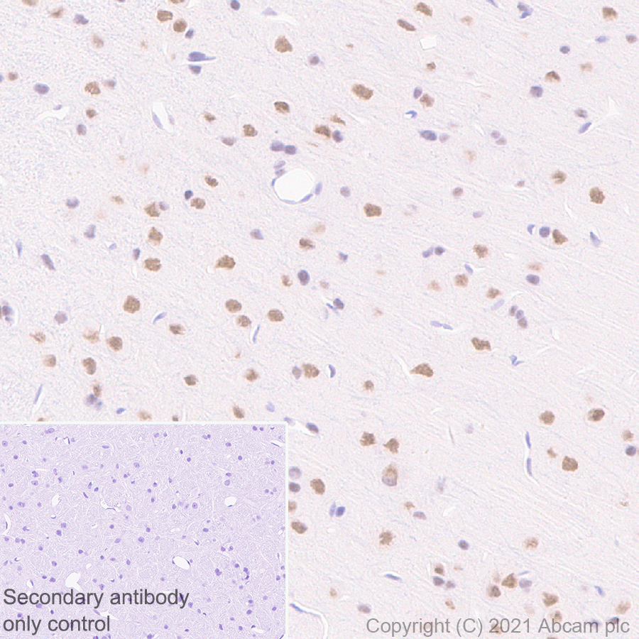Immunohistochemistry (Formalin/PFA-fixed paraffin-embedded sections) - Anti-BAP1 antibody [EPR22826-65] (AB255611), expandable thumbnail