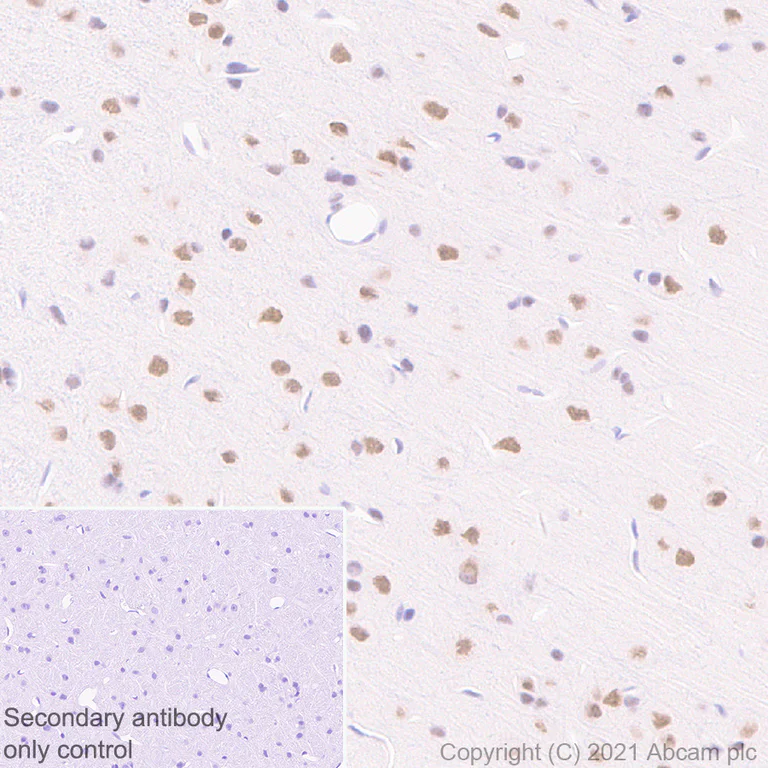 Immunohistochemistry (Formalin/PFA-fixed paraffin-embedded sections) - Anti-BAP1 antibody [EPR22826-65] (AB255611)