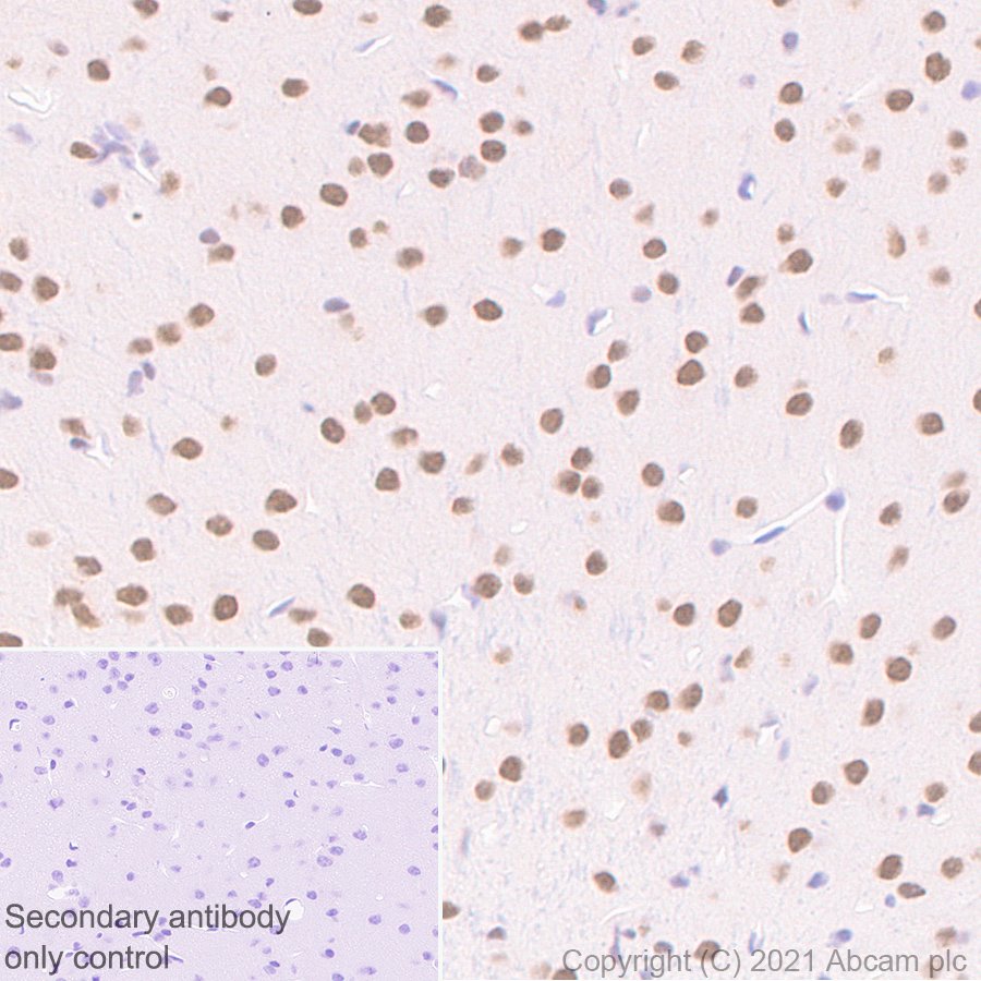 Immunohistochemistry (Formalin/PFA-fixed paraffin-embedded sections) - Anti-BAP1 antibody [EPR22826-65] (AB255611), expandable thumbnail