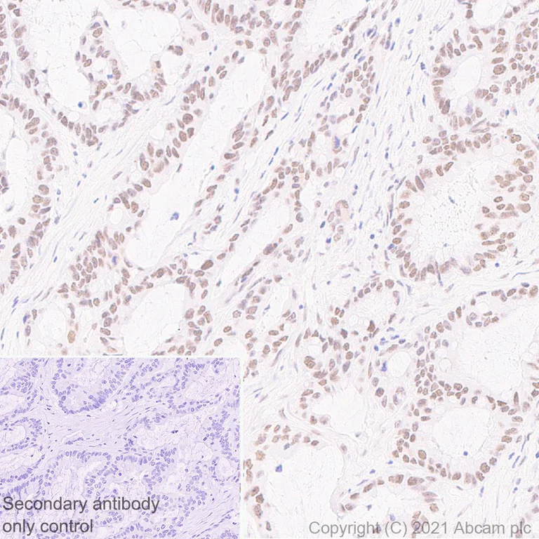 Immunohistochemistry (Formalin/PFA-fixed paraffin-embedded sections) - Anti-BAP1 antibody [EPR22826-65] - BSA and Azide free (AB256480)