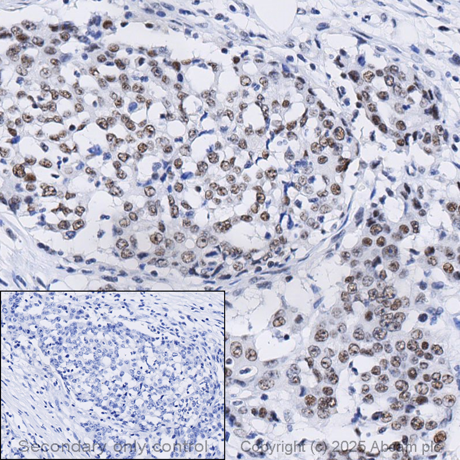 Immunohistochemistry (Formalin/PFA-fixed paraffin-embedded sections) - Anti-BAP1 antibody [EPR22826-65] - BSA and Azide free (AB256480)