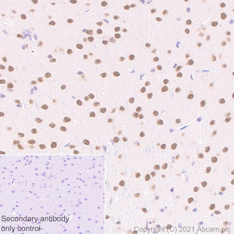 Immunohistochemistry (Formalin/PFA-fixed paraffin-embedded sections) - Anti-BAP1 antibody [EPR22826-65] - BSA and Azide free (AB256480)