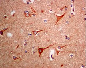 Immunohistochemistry (Formalin/PFA-fixed paraffin-embedded sections) - Anti-BAP29 antibody [EPR7781] (AB129023)