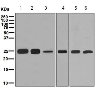 Western blot - Anti-BAP29 antibody [EPR7781] - BSA and Azide free (AB248268)