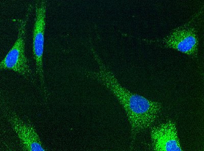 Immunocytochemistry/ Immunofluorescence - Anti-BAP31 antibody [7A3BB6] (AB112993), expandable thumbnail