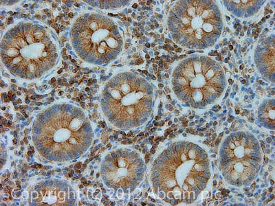 Immunohistochemistry (Formalin/PFA-fixed paraffin-embedded sections) - Anti-BAP31 antibody [7A3BB6] (AB112993), expandable thumbnail