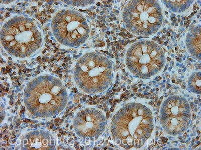 Immunohistochemistry (Formalin/PFA-fixed paraffin-embedded sections) - Anti-BAP31 antibody [7A3BB6] (AB112993)
