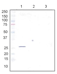 Western blot - Anti-BAP31 antibody [7A3BB6] (AB112993), expandable thumbnail