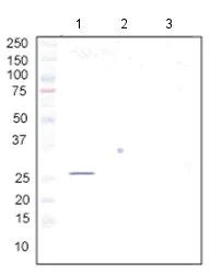 Western blot - Anti-BAP31 antibody [7A3BB6] (AB112993)