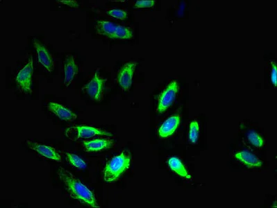 Immunocytochemistry/ Immunofluorescence - Anti-BAP31 antibody (AB237485)