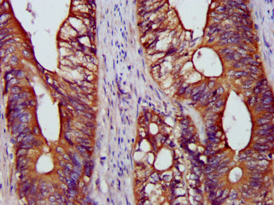 Immunohistochemistry (Formalin/PFA-fixed paraffin-embedded sections) - Anti-BAP31 antibody (AB237485)