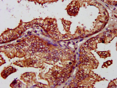 Immunohistochemistry (Formalin/PFA-fixed paraffin-embedded sections) - Anti-BAP31 antibody (AB237485)