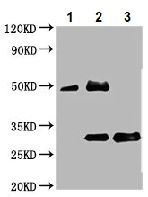 Immunoprecipitation - Anti-BAP31 antibody (AB237485)