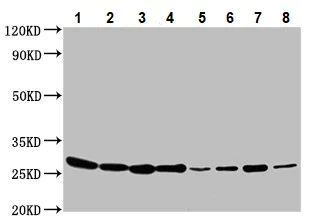 Western blot - Anti-BAP31 antibody (AB237485)