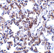 Immunohistochemistry (Formalin/PFA-fixed paraffin-embedded sections) - Anti-BAP31 antibody (AB37120), expandable thumbnail