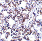 Immunohistochemistry (Formalin/PFA-fixed paraffin-embedded sections) - Anti-BAP31 antibody (AB37120)
