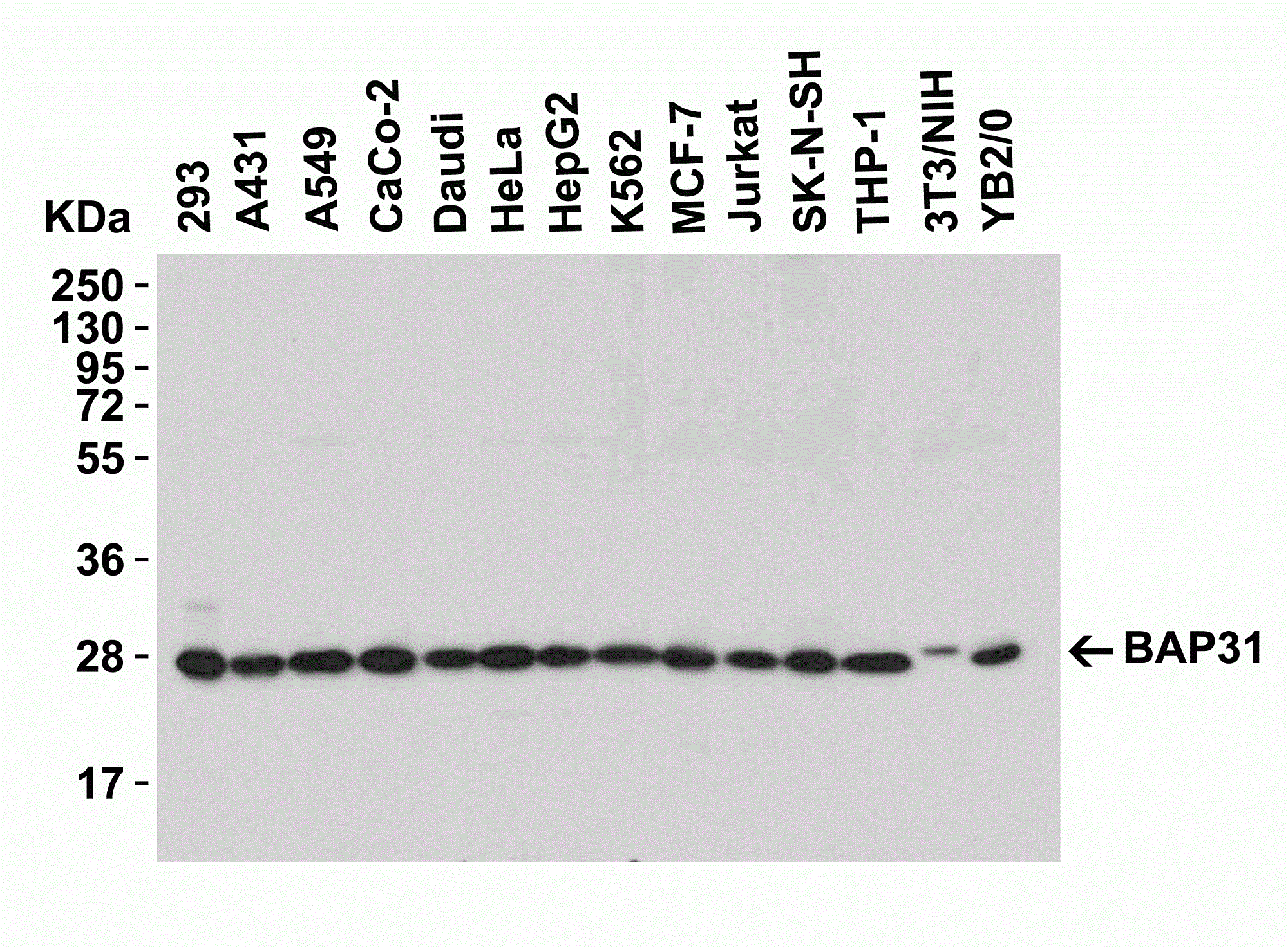 Western blot - Anti-BAP31 antibody (AB37120), expandable thumbnail