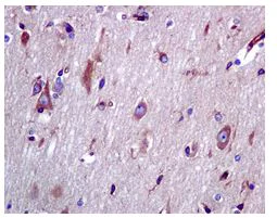Immunohistochemistry (Formalin/PFA-fixed paraffin-embedded sections) - Anti-BAP31 antibody [EPR3878(2)] (AB109304)