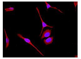 Immunocytochemistry/ Immunofluorescence - Anti-BAP31 antibody [EPR3878(2)] - BSA and Azide free (AB247829), expandable thumbnail