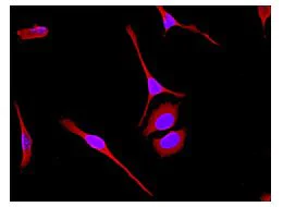 Immunocytochemistry/ Immunofluorescence - Anti-BAP31 antibody [EPR3878(2)] - BSA and Azide free (AB247829)
