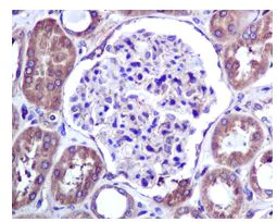 Immunohistochemistry (Formalin/PFA-fixed paraffin-embedded sections) - Anti-BAP31 antibody [EPR3878(2)] - BSA and Azide free (AB247829)