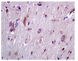 Immunohistochemistry (Formalin/PFA-fixed paraffin-embedded sections) - Anti-BAP31 antibody [EPR3878(2)] - BSA and Azide free (AB247829), expandable thumbnail