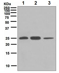 Western blot - Anti-BAP31 antibody [EPR3878(2)] - BSA and Azide free (AB247829), expandable thumbnail