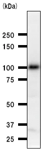 Western blot - Anti-BARD1 antibody [2059C4a] (AB50984)