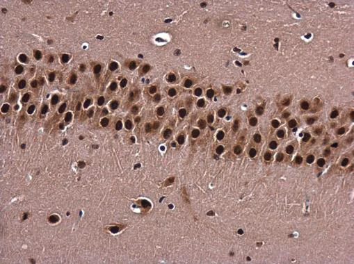Immunohistochemistry (Formalin/PFA-fixed paraffin-embedded sections) - Anti-BARD1 antibody (AB226854)
