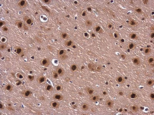Immunohistochemistry (Formalin/PFA-fixed paraffin-embedded sections) - Anti-BARD1 antibody (AB226854)