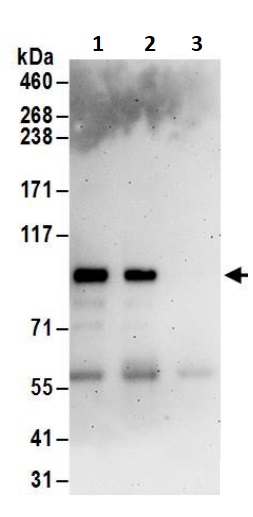 Immunoprecipitation - Anti-BARD1 antibody (AB245434), expandable thumbnail