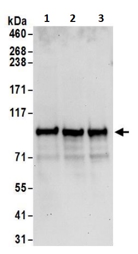 Western blot - Anti-BARD1 antibody (AB245434), expandable thumbnail