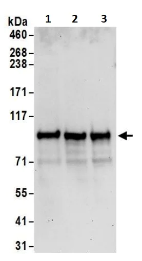 Western blot - Anti-BARD1 antibody (AB245434)
