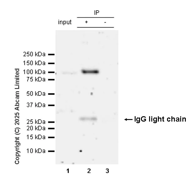 Immunoprecipitation - Anti-BARD1 antibody [EPR29601-553] (AB324523)