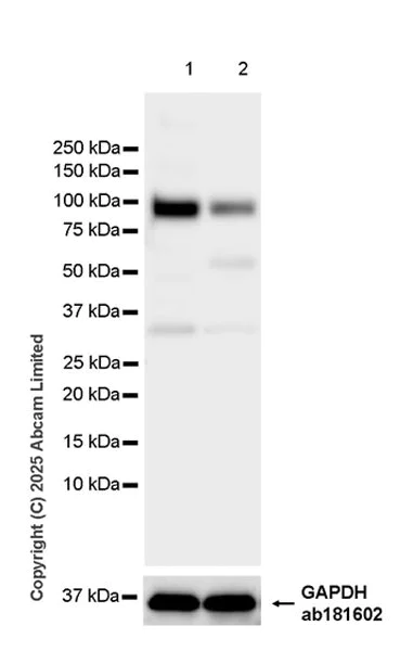 Western blot - Anti-BARD1 antibody [EPR29601-553] (AB324523)
