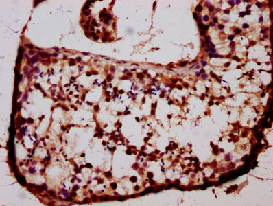 Immunohistochemistry (Formalin/PFA-fixed paraffin-embedded sections) - Anti-BARHL1 antibody (AB235096)
