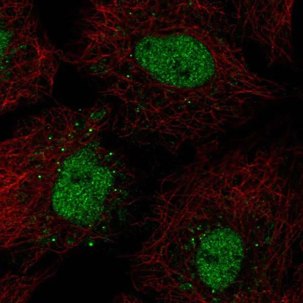 Immunocytochemistry/ Immunofluorescence - Anti-BarX1 antibody (AB220859)