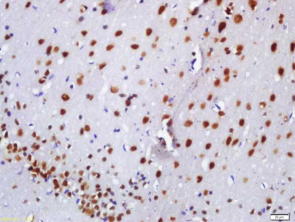 Immunohistochemistry (Formalin/PFA-fixed paraffin-embedded sections) - Anti-BASP1 antibody (AB214322)
