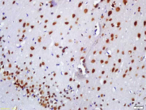 Immunohistochemistry (Formalin/PFA-fixed paraffin-embedded sections) - Anti-BASP1 antibody (AB214322)