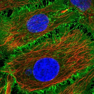 Immunocytochemistry/ Immunofluorescence - Anti-BASP1 antibody (AB220739), expandable thumbnail