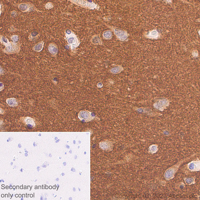 Immunohistochemistry (Formalin/PFA-fixed paraffin-embedded sections) - Anti-BASP1 antibody [EPR28065-75] - BSA and Azide free (AB312323)