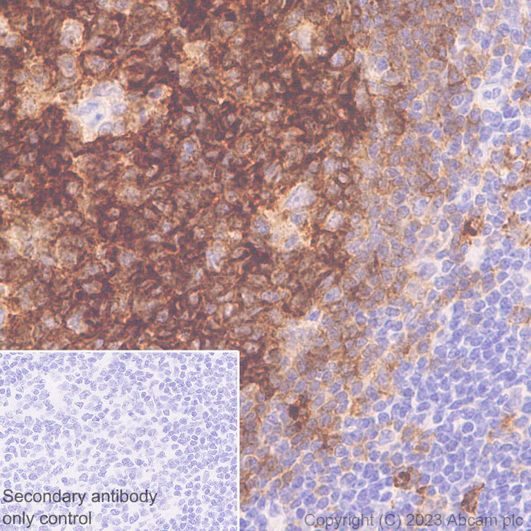 Immunohistochemistry (Formalin/PFA-fixed paraffin-embedded sections) - Anti-BASP1 antibody [EPR28065-75] - BSA and Azide free (AB312323)