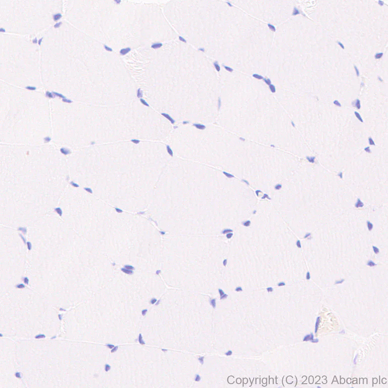 Immunohistochemistry (Formalin/PFA-fixed paraffin-embedded sections) - Anti-BASP1 antibody [EPR28065-75] - BSA and Azide free (AB312323)