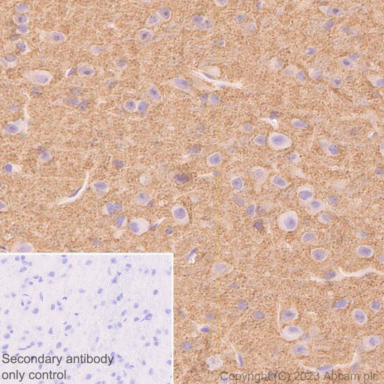 Immunohistochemistry (Formalin/PFA-fixed paraffin-embedded sections) - Anti-BASP1 antibody [EPR28066-51] (AB312324)