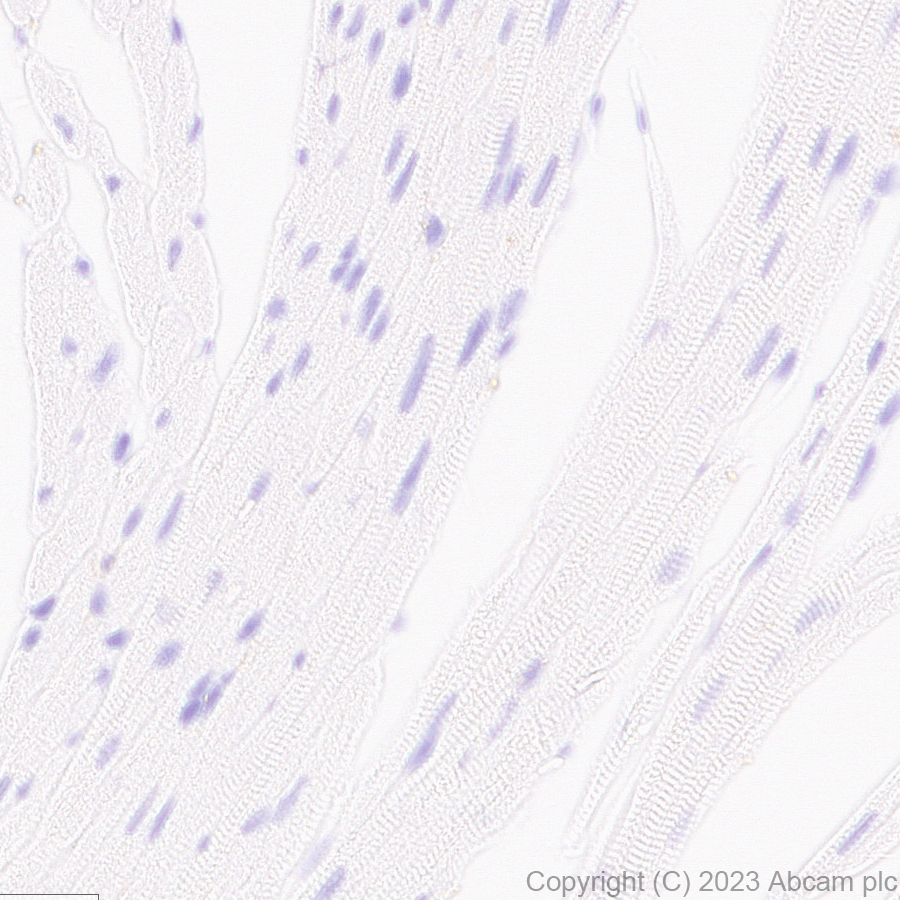 Immunohistochemistry (Formalin/PFA-fixed paraffin-embedded sections) - Anti-BASP1 antibody [EPR28066-51] (AB312324)