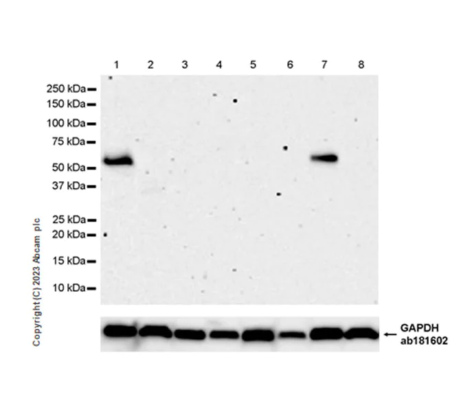 Western blot - Anti-BASP1 antibody [EPR28066-51] (AB312324)