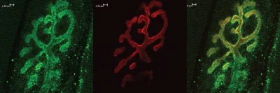 Immunohistochemistry (Formalin/PFA-fixed paraffin-embedded sections) - Anti-Bassoon/BSN antibody (AB110426)