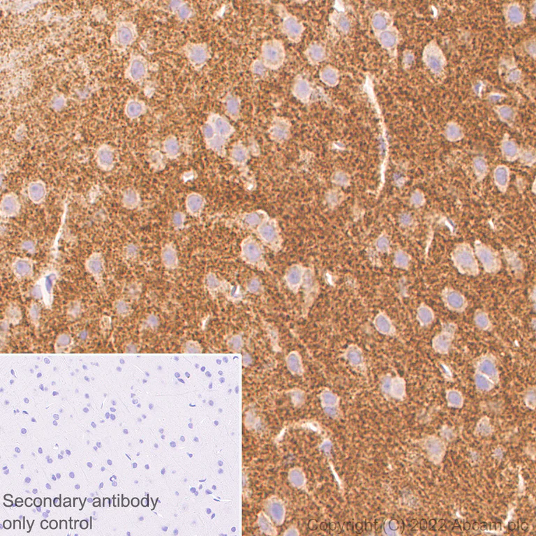 Immunohistochemistry (Formalin/PFA-fixed paraffin-embedded sections) - Anti-Bassoon/BSN antibody [L124-59] - BSA and Azide Free (AB306594)