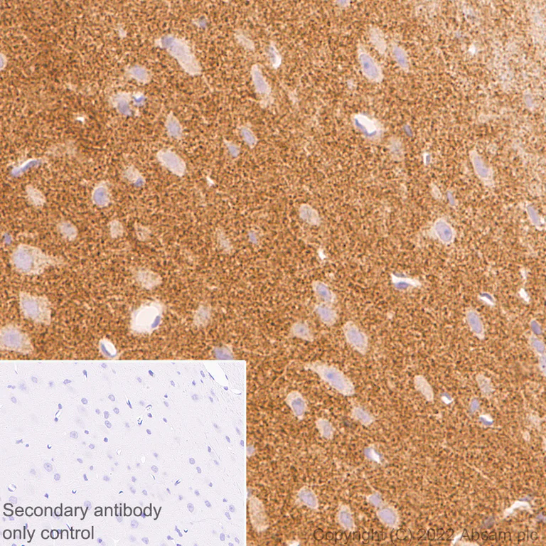 Immunohistochemistry (Formalin/PFA-fixed paraffin-embedded sections) - Anti-Bassoon/BSN antibody [L124-59] - BSA and Azide Free (AB306594)